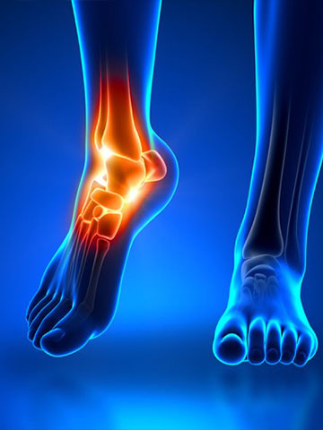 Ayak ve Ayak Bileği Hastalıkları