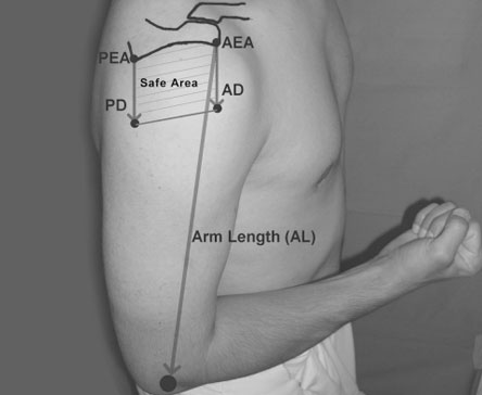 Is there a safe area for the axillary nerve in the deltoid muscle? A cadaveric study, 2006