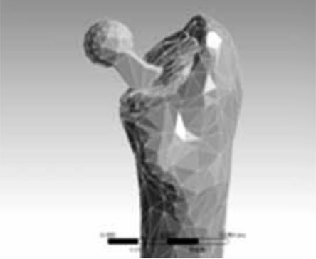 Kalkar defekti olan femur intertrokanterik kırıklarında diafizer çimento desteğinin femur üst uç yük dağılımına etkisinin sonlu element analizi ile tayini, 2013